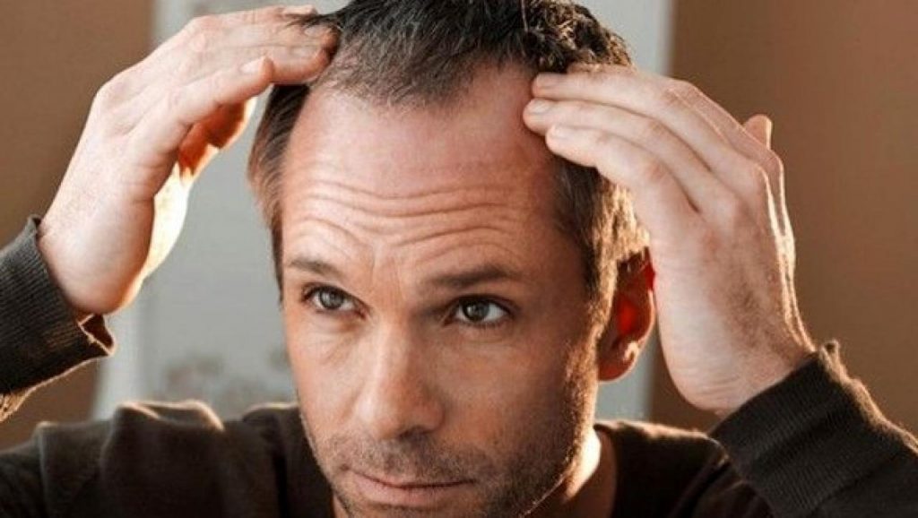 nuevos avances contra la alopecia