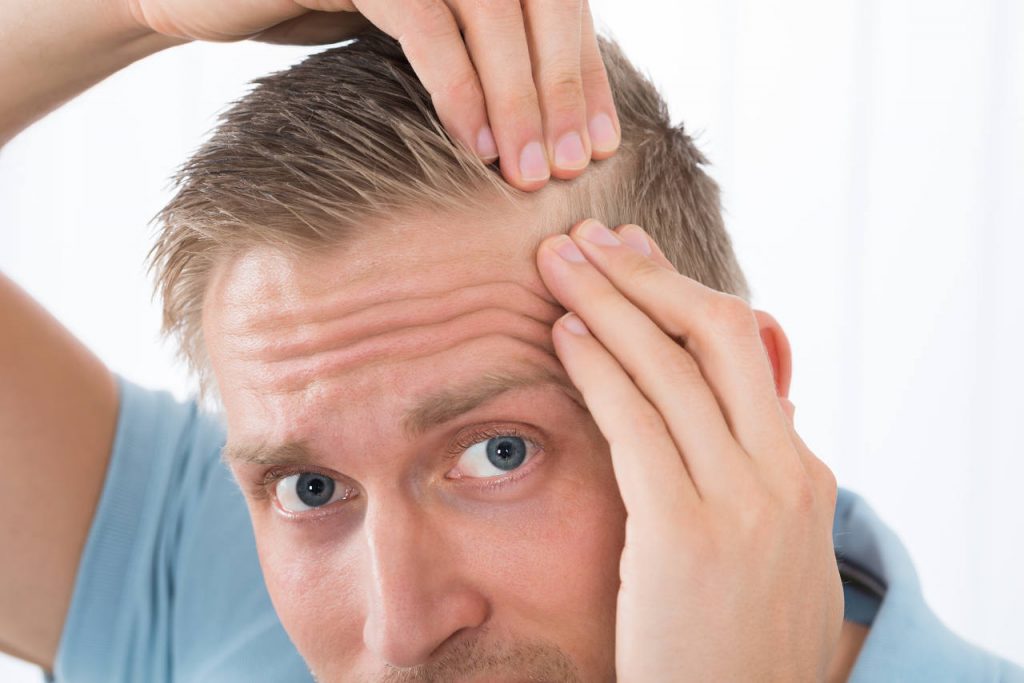 consecuencias psicológicas de la alopecia